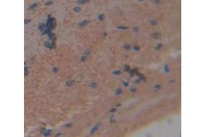 Used in DAB staining on fromalin fixed paraffin- embedded brain tissue (NCDN antibody  (AA 2-300))