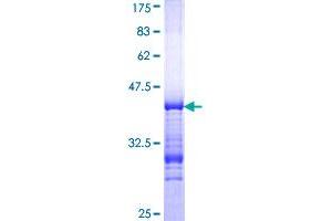 Image no. 1 for Nuclear Receptor Co-Repressor 2 (NCOR2) (AA 1-110) protein (GST tag) (ABIN1312140) (NCOR2 Protein (AA 1-110) (GST tag))