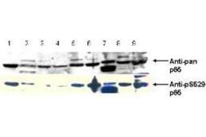 Image no. 2 for anti-Nuclear Factor-kB p65 (NFkBP65) (pSer276) antibody (ABIN1103942) (NF-kB p65 antibody  (pSer276))