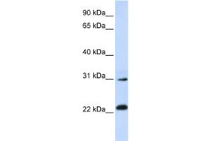 WB Suggested Anti-AP3S1 Antibody Titration: 0. (AP3S1 antibody  (N-Term))