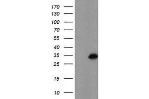 HEK293T cells were transfected with the pCMV6-ENTRY control (Left lane) or pCMV6-ENTRY MLF1 (Right lane) cDNA for 48 hrs and lysed. (MLF1 antibody)