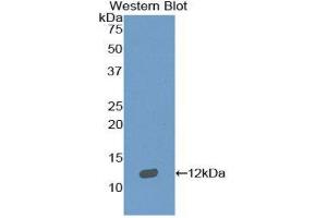 Western Blotting (WB) image for anti-Sema Domain, Immunoglobulin Domain (Ig), Short Basic Domain, Secreted, (Semaphorin) 3E (SEMA3E) (AA 651-740) antibody (ABIN1860520) (SEMA3E antibody  (AA 651-740))
