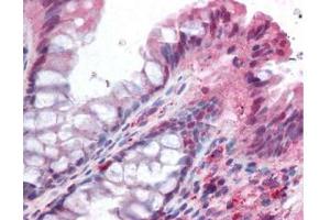 affinity purified anti-NOXO1 antibody was used at 5 ug/ml to detect signal in a variety of tissues including multi-human, multi-brain and multi-cancer slides. (NOXO1 antibody  (AA 238-252))