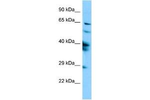 Western Blotting (WB) image for anti-Sperm Associated Antigen 16 (SPAG16) (N-Term) antibody (ABIN2790381) (SPAG16 antibody  (N-Term))