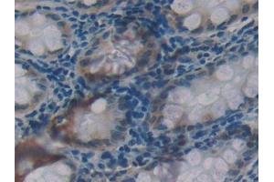 Used in DAB staining on fromalin fixed paraffin- embedded kidney tissue (Glucocorticoid Receptor antibody  (AA 41-184))