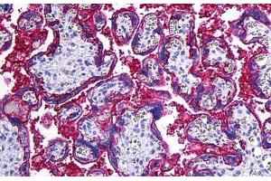 Human Placenta: Formalin-Fixed, Paraffin-Embedded (FFPE) (CD46 antibody)