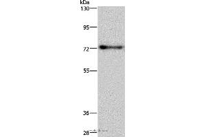 Western blot analysis of Mouse brain tissue, using PATZ1 Polyclonal Antibody at dilution of 1:250 (PATZ1 antibody)