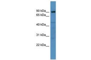 Image no. 1 for anti-ADAM Metallopeptidase Domain 22 (ADAM22) (AA 298-347) antibody (ABIN6746268) (ADAM22 antibody  (AA 298-347))