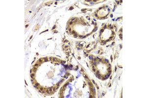 Immunohistochemistry of paraffin-embedded Human mammary gland using HDAC4 antibody at dilution of 1:100 (x40 lens).