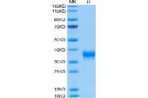 Biotinylated Human BTN1A1 on Tris-Bis PAGE under reduced condition. (BTN1A1 Protein (AA 27-242) (His-Avi Tag,Biotin))