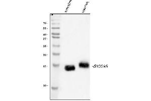 Western blot analysis of S100A9 using anti-S100A9 antibody (ABIN3042482).