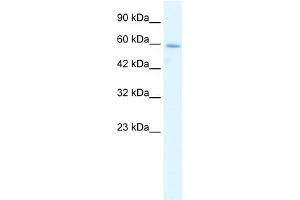 WB Suggested Anti-HCLS1 Antibody Titration:  1. (HCLS1 antibody  (N-Term))