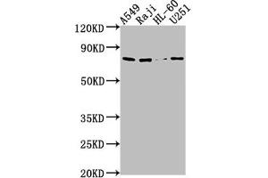 Western Blot Positive WB detected in: A549 whole cell lysate, Raji whole cell lysate, HL60 whole cell lysate, U251 whole cell lysate All lanes: RANBP9 antibody at 1:1000 Secondary Goat polyclonal to rabbit IgG at 1/50000 dilution Predicted band size: 78, 44, 56 kDa Observed band size: 78 kDa (Importin 9 antibody  (AA 158-176))