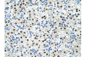 EXOSC4 antibody was used for immunohistochemistry at a concentration of 4-8 ug/ml to stain Hepatocytes (arrows) in Human Liver.