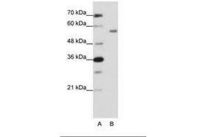 Image no. 1 for anti-Zinc Finger Protein 497 (ZNF497) (N-Term) antibody (ABIN202666)
