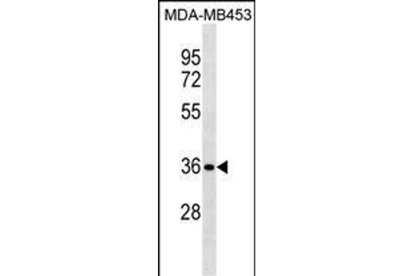 Syntaxin 11 Antikörper  (N-Term)