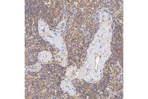 IHC analysis of SGCE using anti-SGCE antibody (ABIN7601544). (SGCE antibody  (AA 38-407))