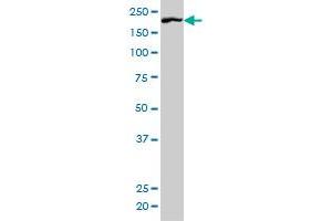 ROCK1 antibody  (AA 401-510)