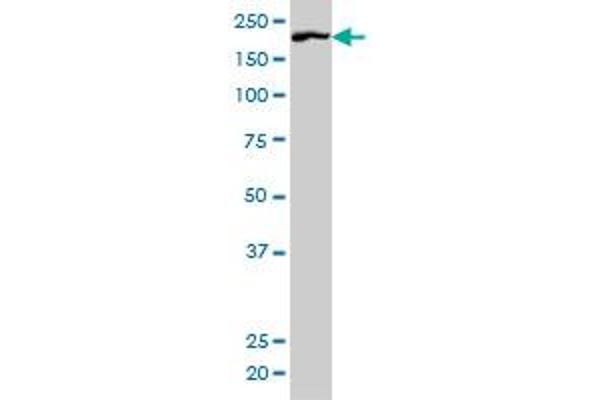 ROCK1 antibody  (AA 401-510)