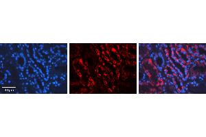 Immunohistochemistry (IHC) image for anti-Apoptosis-Inducing Factor, Mitochondrion-Associated, 1 (AIFM1) (C-Term) antibody (ABIN2778665)