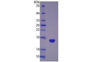 SDS-PAGE (SDS) image for Left-Right Determination Factor 2 (LEFTY2) (AA 245-356) protein (His tag) (ABIN1170866)