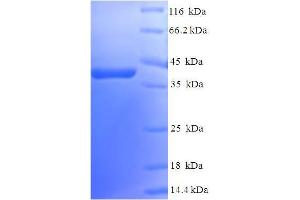 SDS-PAGE (SDS) image for RAB5A, Member RAS Oncogene Family (RAB5A) (AA 1-215), (full length) protein (His-SUMO Tag) (ABIN5710207) (RAB5 Protein (AA 1-215, full length) (His-SUMO Tag))
