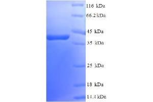 SDS-PAGE (SDS) image for RAB5A, Member RAS Oncogene Family (RAB5A) (AA 1-215), (full length) protein (His-SUMO Tag) (ABIN5710207)