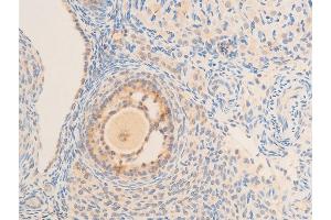 Immunohistochemistry (IHC) image for anti-Nuclear Factor of kappa Light Polypeptide Gene Enhancer in B-Cells Inhibitor, epsilon (NFKBIE) (pSer161) antibody (ABIN6255101)