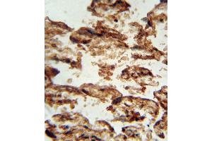 IGFBP4 antibody (Center) (ABIN652262 and ABIN2841131) immunohistochemistry analysis in formalin fixed and paraffin embedded human placenta tissue followed by peroxidase conjugation of the secondary antibody and DAB staining. (IGFBP4 antibody  (AA 96-124))