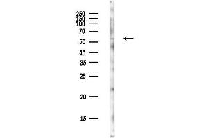 anti-T-Box 4 (TBX4) antibody
