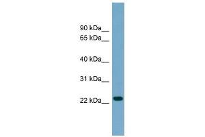 ARL8B antibody used at 1 ug/ml to detect target protein. (ARL8B antibody  (Middle Region))