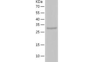 Western Blotting (WB) image for Telomerase Reverse Transcriptase (TERT) (AA 595-928) protein (His tag) (ABIN7125334) (TERT Protein (AA 595-928) (His tag))