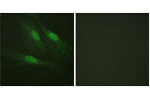 Immunofluorescence analysis of HeLa cells, using Catenin-beta (Ab-654) Antibody. (beta Catenin antibody  (AA 620-669))