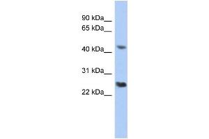 WB Suggested Anti-RYBP Antibody Titration:  0.