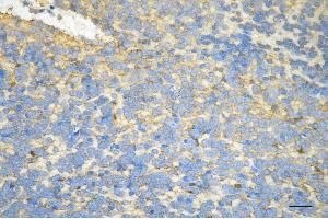 anti-Creatine Kinase, Brain (CKB) antibody