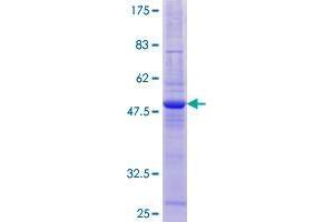 TIMM22 Protein (AA 1-194) (GST tag)