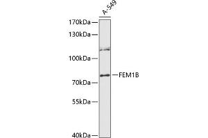 Western blot analysis of extracts of A-549 cells, using FEM1B antibody (ABIN6131634, ABIN6140575, ABIN6140577 and ABIN6216558) at 1:3000 dilution. (FEM1B antibody  (AA 368-627))