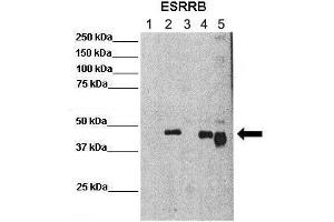 Lanes :  Lane 1: 25ug mouse ES cellsLane 2: 25ug mouse ES cells overexpressing FLAG EsrrB (mouse)Lane 3: 25ug chromatin fraction CV1 cellsLane 4: 25ug chromatin fraction CV1 cells overexpressing FLAG EsrrB (mouse)Lane 5: 25ug chromatin fraction CV1 cells overexpressing FLAG EsrrB-Deltacter (mouse)   Primary Antibody Dilution :   1:500    Secondary Antibody :  Anti-rabbit-HRP   Secondary Antibody Dilution :   1:3000   Gene Name :  ESRRB   Submitted by :  Domenico Maiorano, Institute of Human Genetics (IGH) (ESRRB antibody  (N-Term))