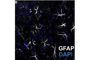 Representative image of GFP positive (white, cat. (GFAP antibody  (AA 411-422))