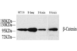 Western Blot analysis of various samples using Catenin beta Polyclonal Antibody at dilution of 1:1000. (beta Catenin antibody)