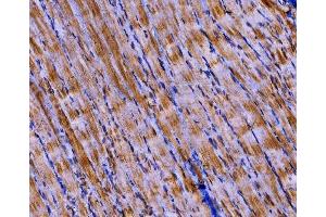 IHC analysis of PKM2 using anti-PKM2 antibody (ABIN3043381).