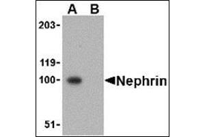 Western blot analysis in mouse kidney tissue lysate using Nephrin Antibody at 1 μg/ml in the (A) absence and (B) presence of blocking peptide. (Nephrin antibody  (C-Term))