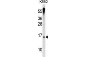Western blot analysis in K562 cell line lysates (35ug/lane) using MAD3 Antibody (N-term). (MXD3 antibody  (N-Term))