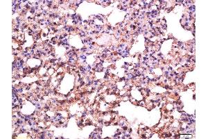 Formalin-fixed and paraffin embedded rat lung labeled with Anti-Sialoadhesin Polyclonal Antibody, Unconjugated  at 1:500 followed by conjugation to the secondary antibody and DAB staining (Sialoadhesin/CD169 antibody  (AA 851-950))