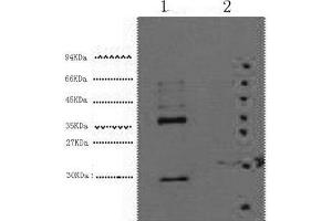 Western Blot analysis of 1) Hela, 2) 293T cells using CA9 Monoclonal Antibody at dilution of 1:5000. (CA9 antibody)