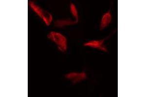 ABIN6274756 staining HeLa cells by IF/ICC. (RPS4X antibody  (Internal Region))