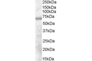 ABIN185227 (1µg/ml) staining of Human Thymus lysate (35µg protein in RIPA buffer). (DEF6 antibody  (N-Term))