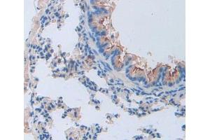 Used in DAB staining on fromalin fixed paraffin- embedded lung tissue (Cathepsin W antibody  (AA 22-371))