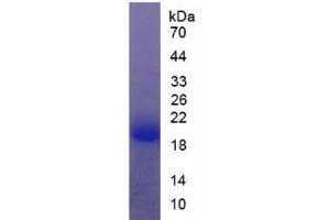 SDS-PAGE analysis of Rat Thyroid Peroxidase Protein. (Thyroperoxidase Protein)