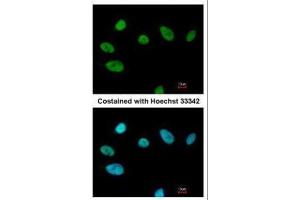 ICC/IF Image Immunofluorescence analysis of paraformaldehyde-fixed A549, using SOX2, antibody at 1:200 dilution. (SOX2 antibody)